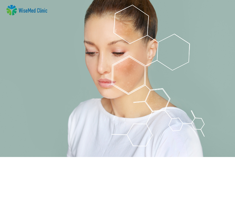 Glutathione IV injection therapy for skin brightening and detoxification